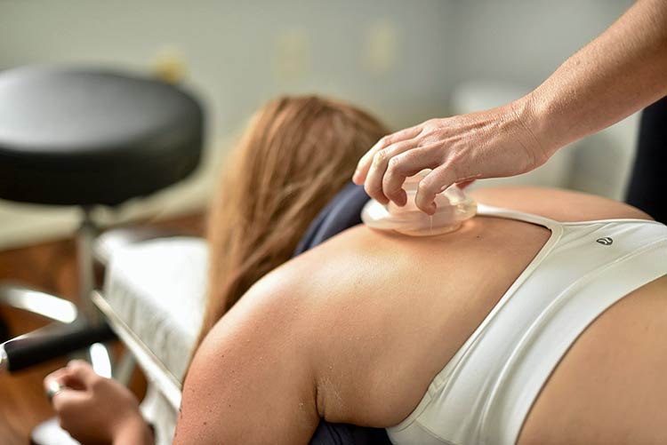 southwest-austin-sports-chiropractor-cupping